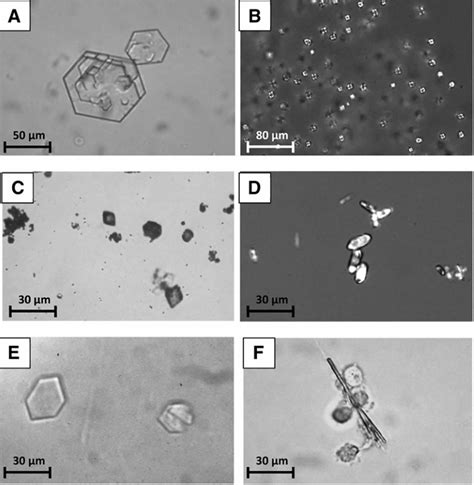 Crystals In Urine Cause What Does It Mean To Have Crystals In Urine