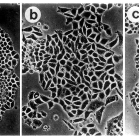 Reversible Morphological Changes Induced By Retinoic Acid In HeLa Sr