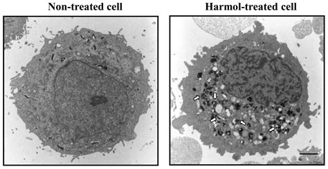 Harmol Induces Autophagy And Subsequent Apoptosis In U Mg Human