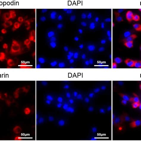 The Immunofluorescence Staining To Label Synaptopodin A And Nephrin B