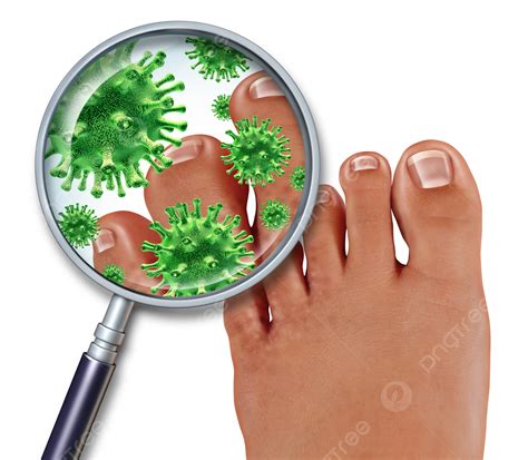 Foot Fungus White Background Foot Medicine Symptoms Photo And Picture For Free Download - Pngtree