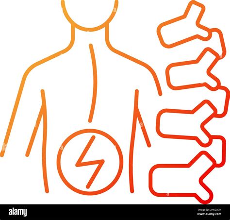 Degenerative Scoliosis Gradient Linear Vector Icon Stock Vector Image And Art Alamy