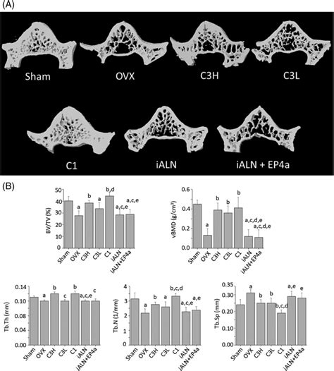 Treatment effects on the microarchitecture of the sixth lumbar... | Download Scientific Diagram