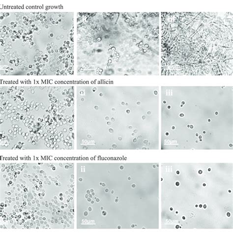 Candida Albicans Microscope Slide