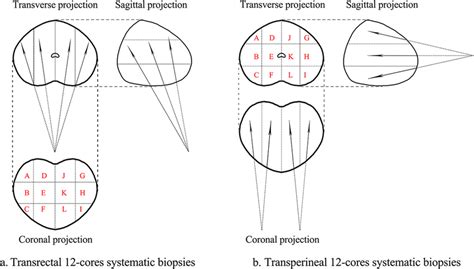 Transrectal And Transperineal Prostate Biopsy Model Diagram Download Scientific Diagram