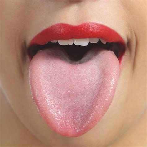 Black Tongue Symptoms | Livestrong.com