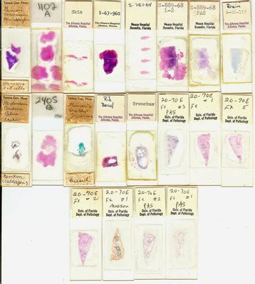 Human Pathology Microscope Slides -- Antique Price Guide Details Page