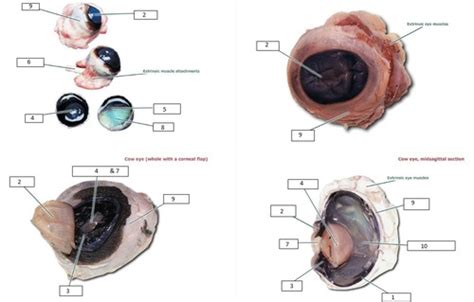 BIOL 2401 Lab Exam 3 Special Senses Vision Ex 17 Flashcards Quizlet