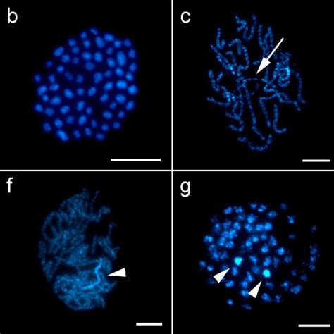 Sex Chromatin Assay In Polyploid Nuclei From Malpighian Tubules Of