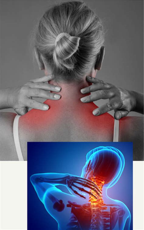 Neck Pain - twinhillshealth.com