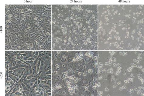 Effect Of Pyy On Miapaca 2 Cell Morphology The Cells Were Treated By