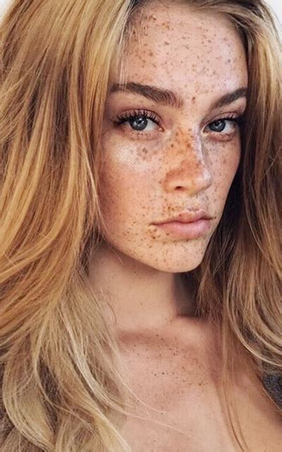 Swantje Paulina Beautiful Freckles Freckles Freckles Girl