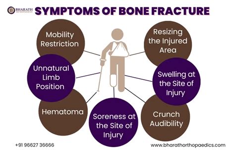 Signs Of Bone Fracture