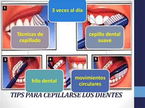 Presentación Efectiva Técnicas De Cepillado