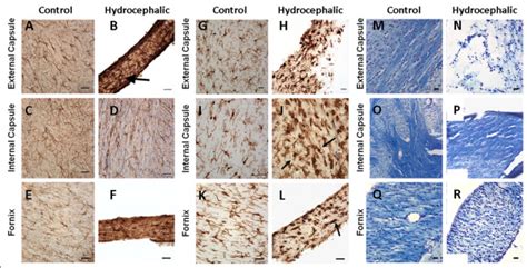 Representative Photomicrographs Of Gfap A F Iba G L And Lfb