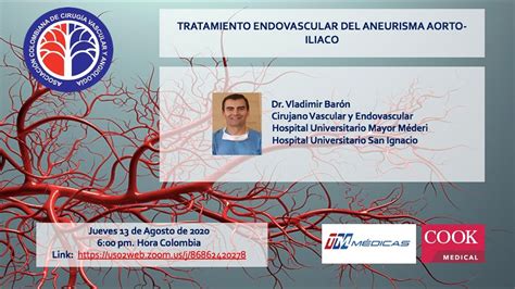 Tratamiento Endovascular Del Aneurisma Aorto Iliaco Youtube