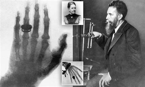 Wilhelm Röntgen su aportación a la medicina