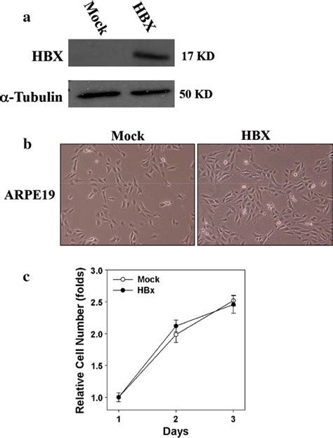 Effects Of The Hbx Protein On Morphology And Growth Rate In Retinal