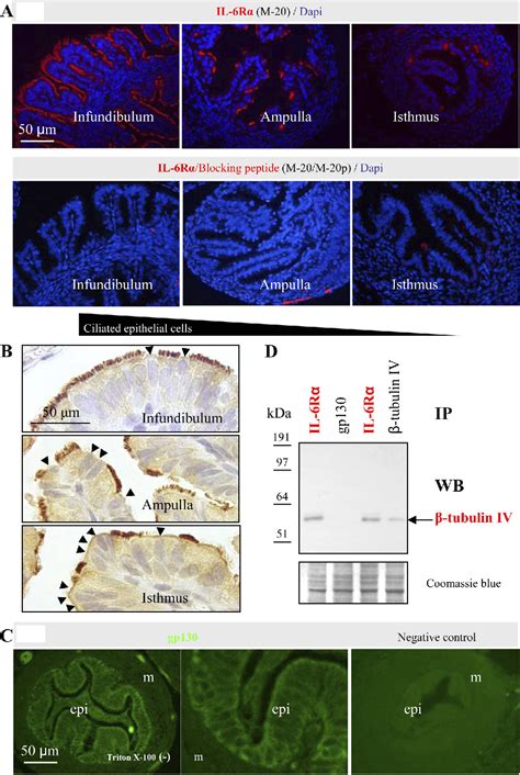 Figure 1 From Downregulation Of Cilia Localized Il 6r Cid1 By 17 Cid2 Estradiol In Mouse