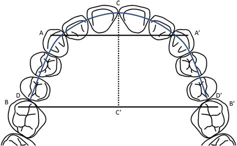 Relationship Between Vertical Facial Morphology And Dental Arch