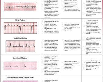 13 Cardiac Rhythm And Dysrhythmias Cheat Sheet Any Nurse Must Know For