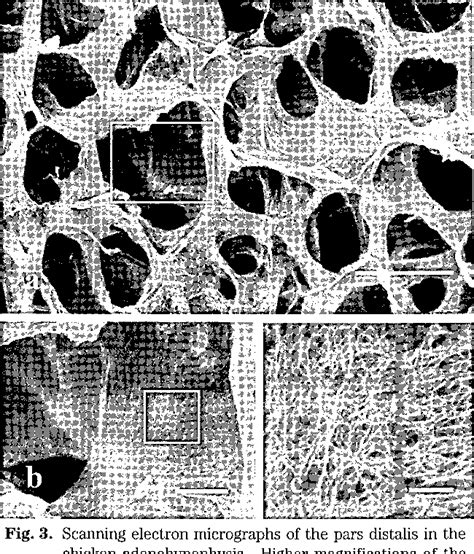 Figure 3 From Scanning Electron Microscopic Comparison Of The Three