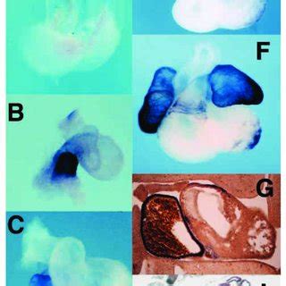 Time Course Of Smyhc Expression During Cardiac Development In The