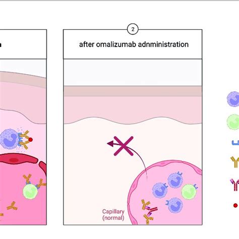 In Urticaria Step Activated Basophils Migrate To The Skin