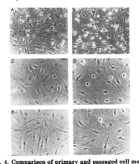 Figure From Discoordinate Expression Of Stromelysin Collagenase And