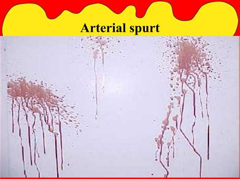 PPT - Blood Spatter Analysis PowerPoint Presentation, free download ...