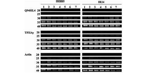 Reverse Transcription Polymerase Chain Reaction Rt Pcr Analysis Of