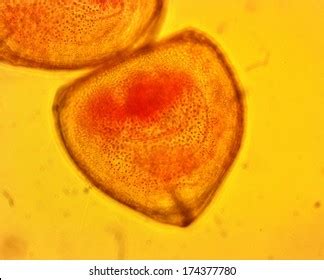 21 Glochidium Images, Stock Photos & Vectors | Shutterstock