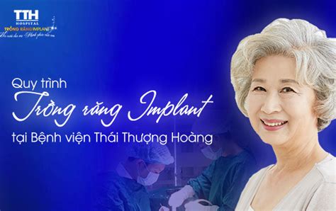 Quy trình trồng răng Implant tại Thái Thượng Hoàng