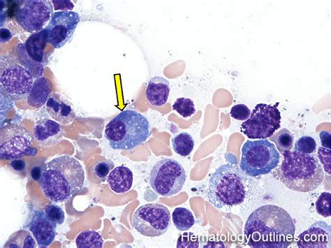 Hematologyoutlines Atlas