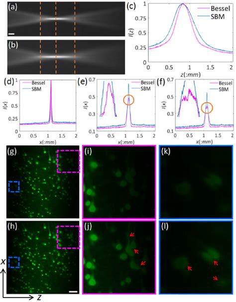 Neural Imaging By LSFM With The Bessel Beam And The Schwartz Bessel