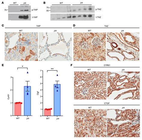 Jci Scf Skp2 E3 Ubiquitin Ligase Links Mtorc1er Stressisr With Yap