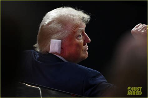 Donald Trump Wears Bandage Over Ear For First Appearance Since Assassination Attempt Photo