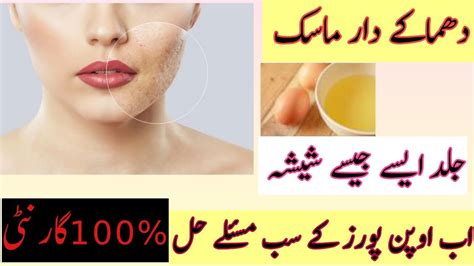 How To Get Rid Of Large Open Pores How To Reduce Open Pores Home