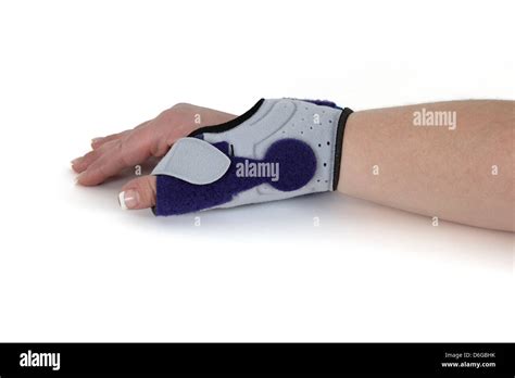 Wrist Bandage Shown On A Womans Hand Wrist Orthosis For Treating A