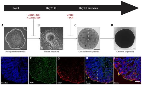 If Human Brain Organoids Are The Answer To Understanding Dementia What