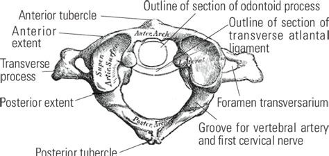 Figure 1 From Computed Tomography Scan Based Morphometric Analysis Of Lateral Masses Of Atlas