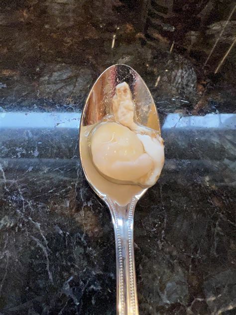 This under-developed egg embryo in my fully developed egg. : r