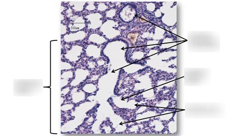 Lung parenchyma Diagram | Quizlet
