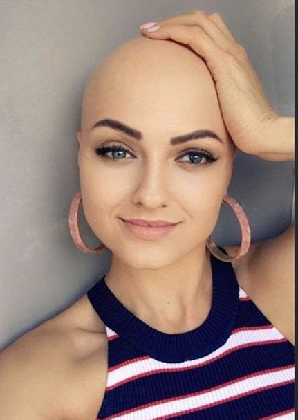 Best Alopecia Images Bald Women Bald Girl Shaved Head 76002 Hot Sex