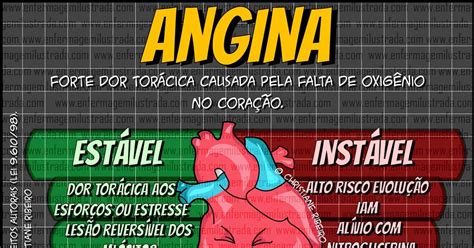 Angina Estável E Instável BRAINCP