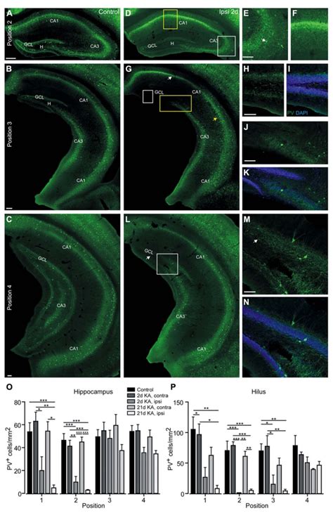 Parvalbumin Positive Cells Are Lost In The Septal And Intermediate