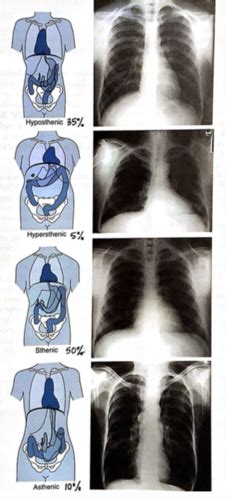 Radiography Of The Chest Flashcards Quizlet