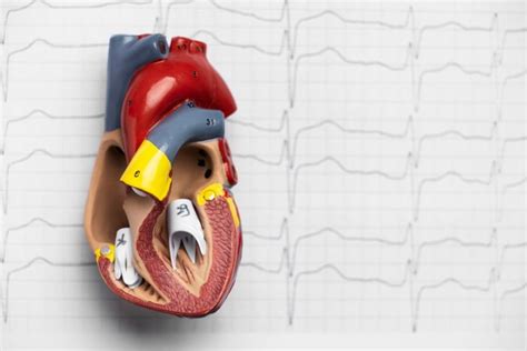 Fibrilação Atrial Sintomas Diagnóstico E Opções De Tratamento Átrios