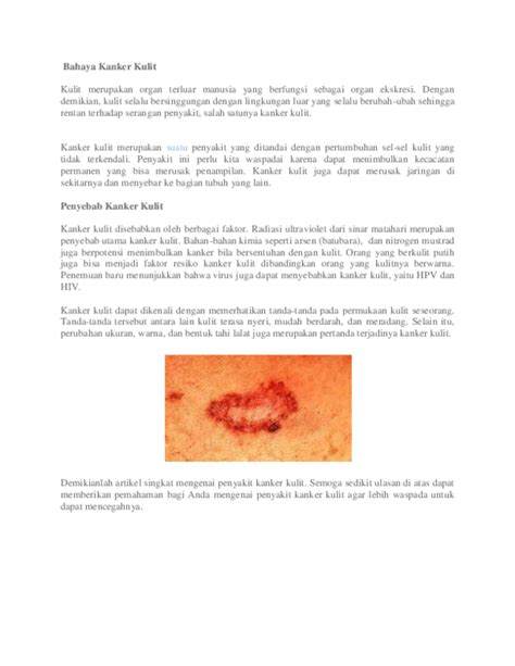 bahaya kanker kulit