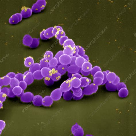 Enterococcus Faecalis Gram Stain